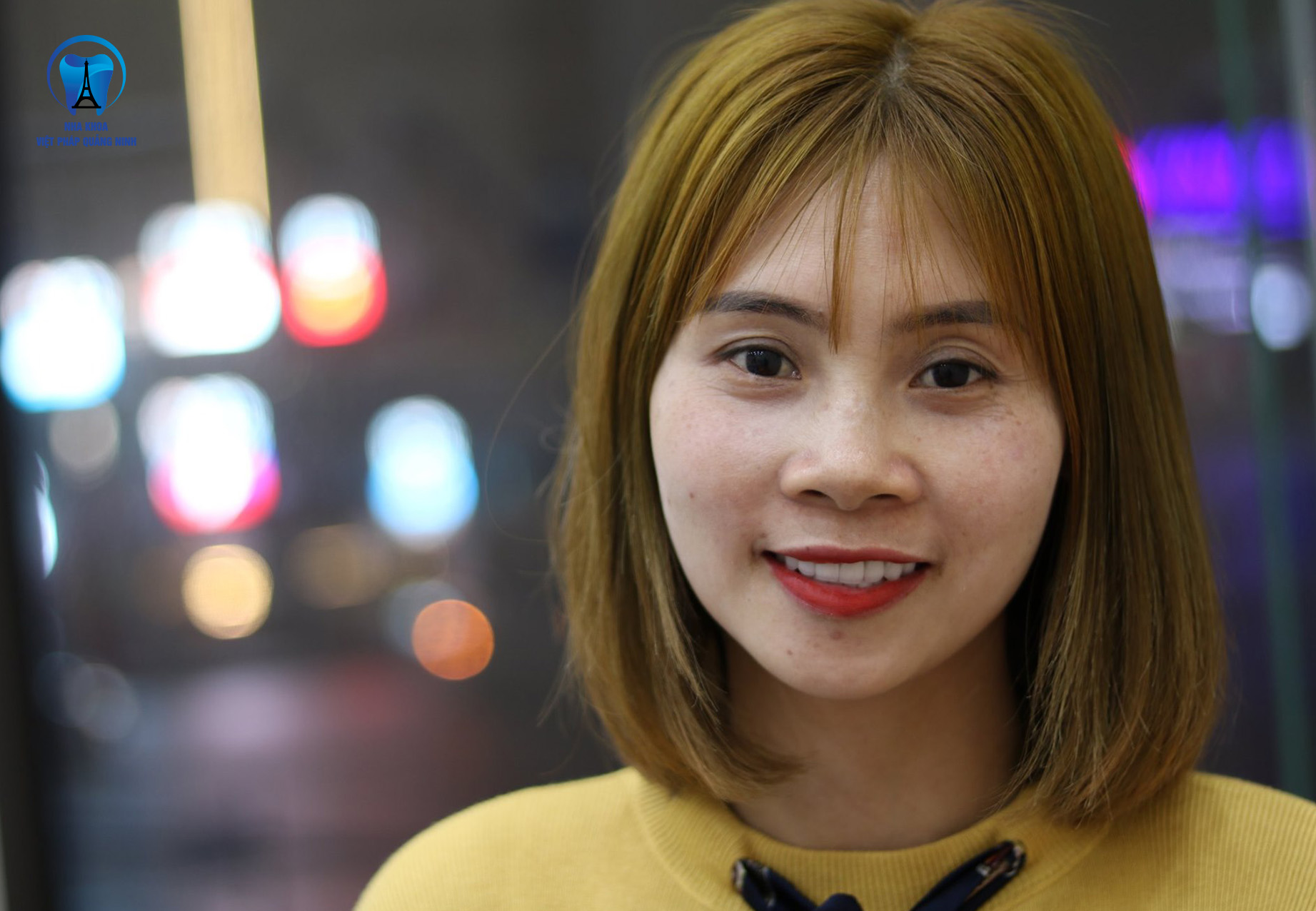 Bọc răng sứ có tốt không? Những ưu điểm của việc bọc răng sứ?
